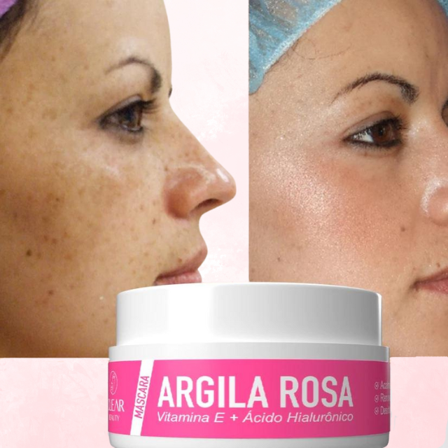 Máscara Facial 3 em 1 + Ácido Hialurônico - 90g